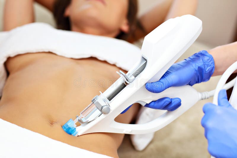 Kobieta ma podbrzusze mesotherapy w piękno salonie obrazy royalty free Kobieta ma podbrzusze mesotherapy w piękno salonie obrazy royalty free