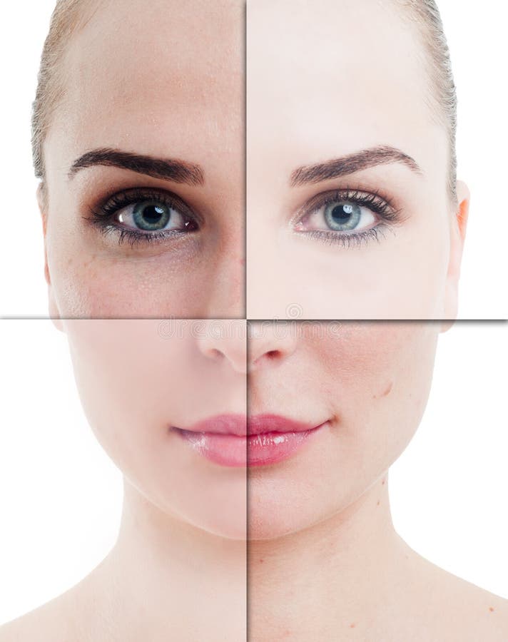 Kobiety twarz dzielił w częściach z perfect i niedokonaną skórą obraz stock Kobiety twarz dzielił w częściach z perfect i niedokonaną skórą obraz stock