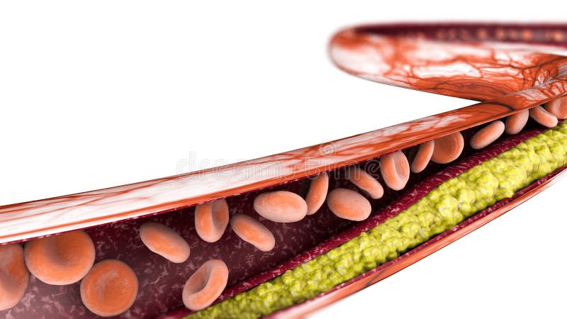 Kolesterolbildande, fett avsnitt 3d av en artär, en åder och röda blodceller, hjärta vektor illustrationer Kolesterolbildande, fett avsnitt 3d av en artär, en åder och röda blodceller, hjärta vektor illustrationer