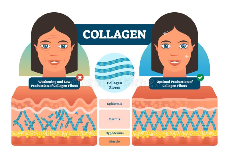 Kollagenvektorillustration Medizinischer und anatomischer beschrifteter Entwurf mit Fasern, Epidermis, hypodermis und dem Muskel vektor abbildung Kollagenvektorillustration Medizinischer und anatomischer beschrifteter Entwurf mit Fasern, Epidermis, hypodermis und dem Muskel vektor abbildung