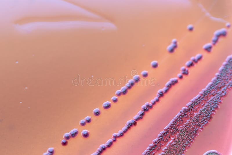 Kolonien-Eigenschaften von Escherichia Coli E Coli lizenzfreie stockbilder