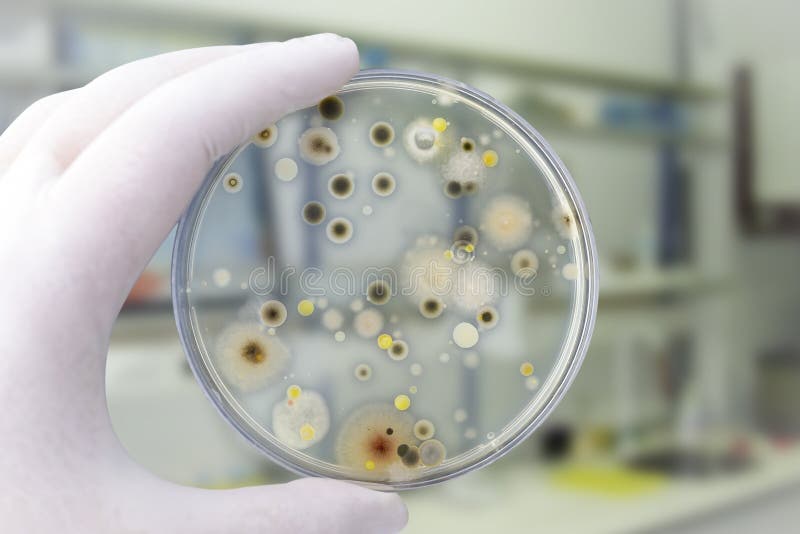 Kolonies van verschillende die bacteri?n en vormpaddestoelen op petrischaal met voedende agar-agar worden gekweekt
