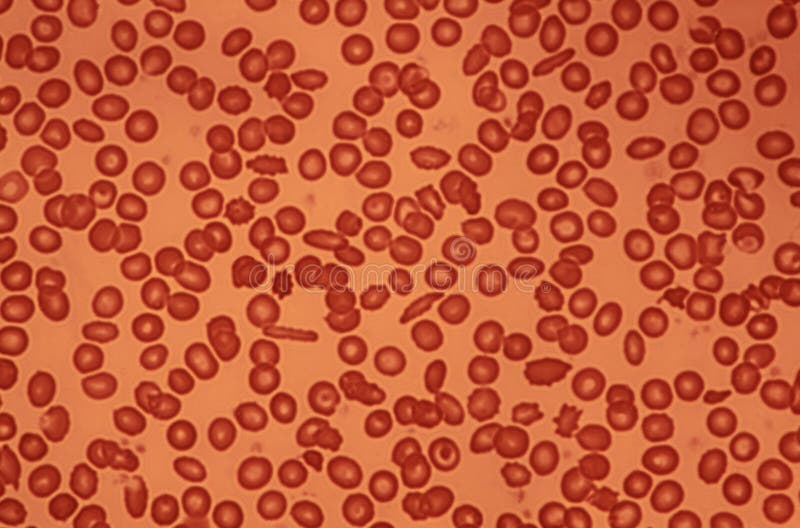 Human Blood Cells viewed through an optical microscope. Human Blood Cells viewed through an optical microscope
