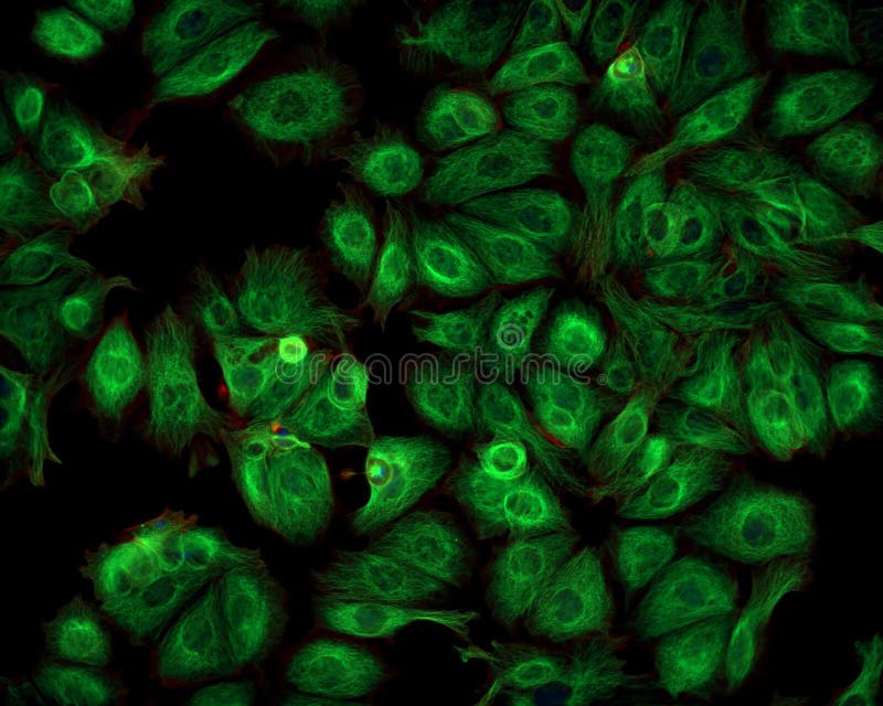 Komórki nowotworowe imaged z fluorescencja mikroskopem