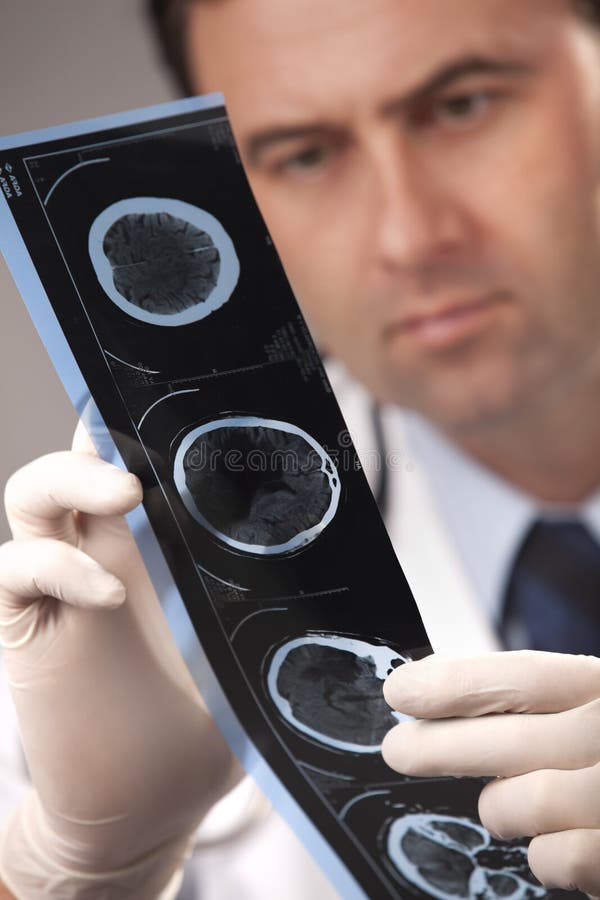 Doctor is checking x- ray computed tomography, studio shot. Doctor is checking x- ray computed tomography, studio shot.