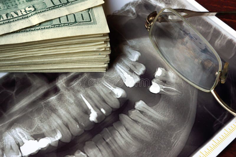 Kosten van tandbehandeling