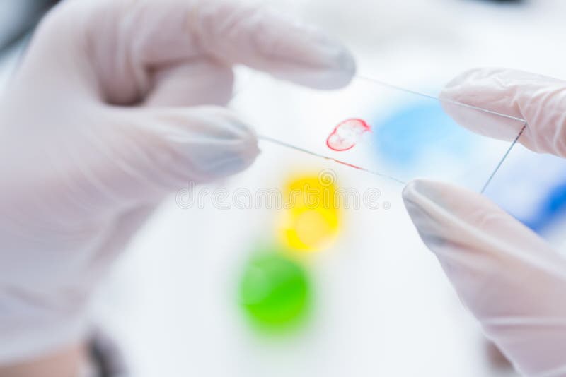 Kvinna i ett laboratoriummikroskop med mikroskopglidbanan i hand royaltyfria bilder