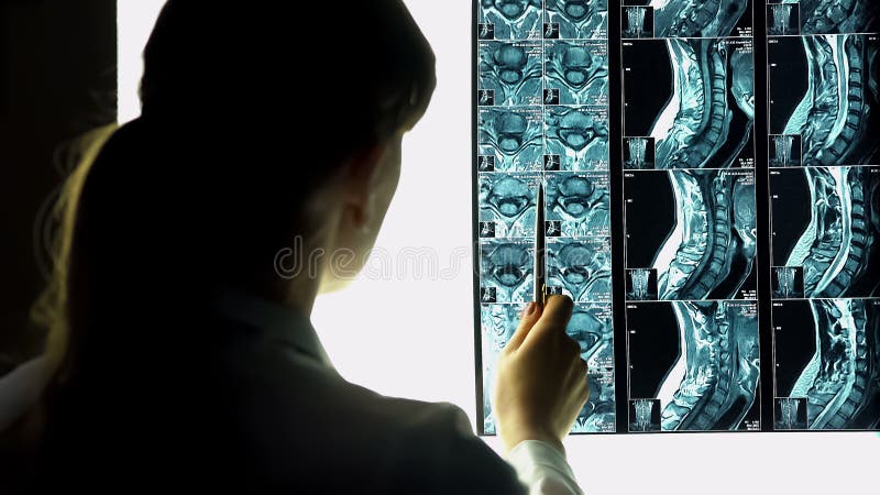 Kvinnlig doktor som pekar på den tålmodiga röntgenstrålen, läkarundersökning, hälsoproblem fotografering för bildbyråer Kvinnlig doktor som pekar på den tålmodiga röntgenstrålen, läkarundersökning, hälsoproblem fotografering för bildbyråer