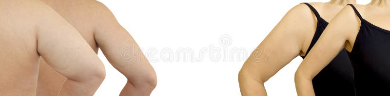 Kvinnlig malehand som före och efter bantar arkivfoto Kvinnlig malehand som före och efter bantar arkivfoto