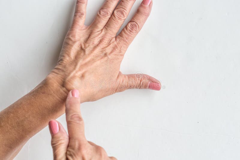 Kyste de ganglion photo stock. Image du photographie - 98594392