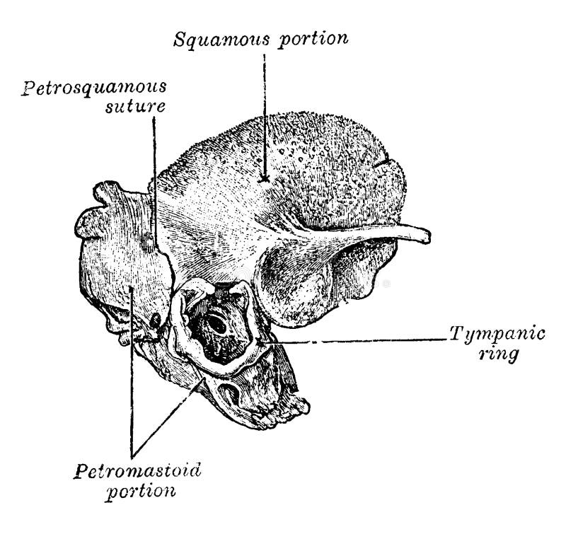 This illustration represents Outer Aspect of Temporal Bone at Birth, vintage line drawing or engraving illustration. This illustration represents Outer Aspect of Temporal Bone at Birth, vintage line drawing or engraving illustration