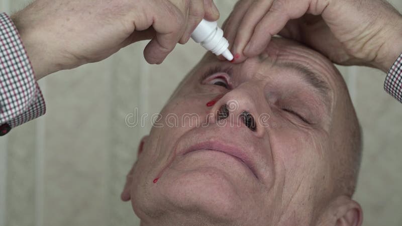 L'homme âgé coule exactement le gros plan rouge spécial d'eyedrops