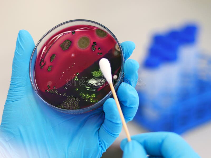 La culture d'e. coli ecoli analyse scientifique avec l'emb d'agar bleu de méthylène d'éosine dans la boîte de Pétri montrent le ve