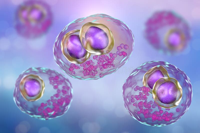 La célula humana del interior del citomegalovirus CMV, inclusión del ojo del ` s del búho en el núcleo, multinucleated la célula, stock de ilustración La célula humana del interior del citomegalovirus CMV, inclusión del ojo del ` s del búho en el núcleo, multinucleated la célula, stock de ilustración
