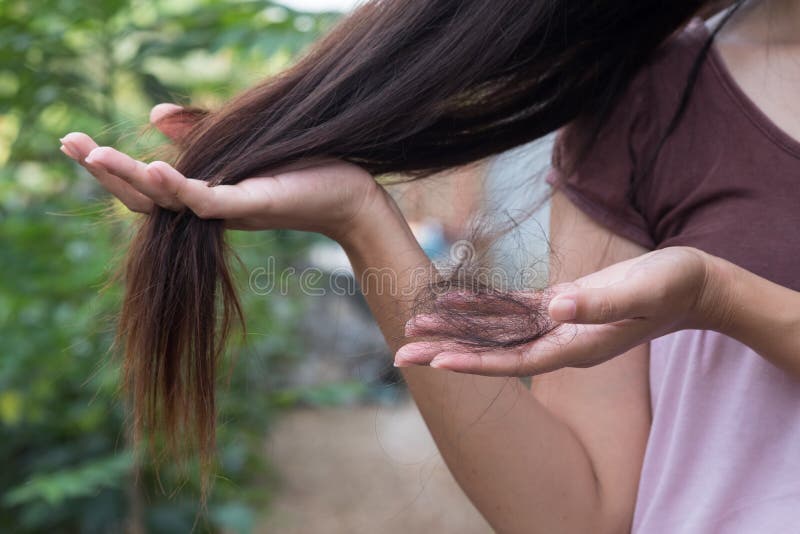 La femme souffre de la perte des cheveux photographie stock libre de droits La femme souffre de la perte des cheveux photographie stock libre de droits