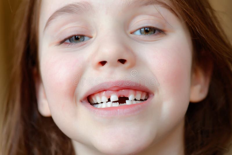 La fille adorable sourit avec la chute des premières dents de lait photo libre de droits