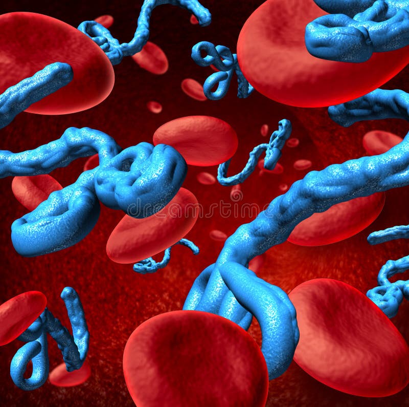 La maladie d'Ebola illustration stock La maladie d'Ebola illustration stock