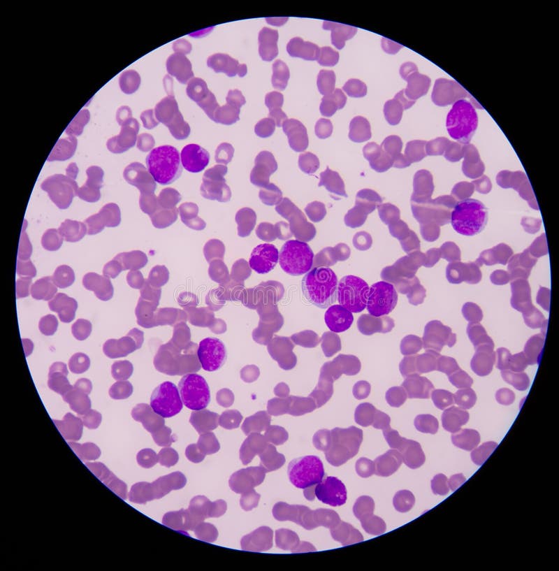 Álbumes 20+ Foto observacion de sangre en el microscopio Lleno Álbumes 20+ Foto observacion de sangre en el microscopio Lleno