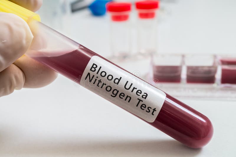La mano tiene la provetta con sangue per la prova dell'azoto dell'urea nel sangue (PANINO) immagini stock libere da diritti La mano tiene la provetta con sangue per la prova dell'azoto dell'urea nel sangue (PANINO) immagini stock libere da diritti
