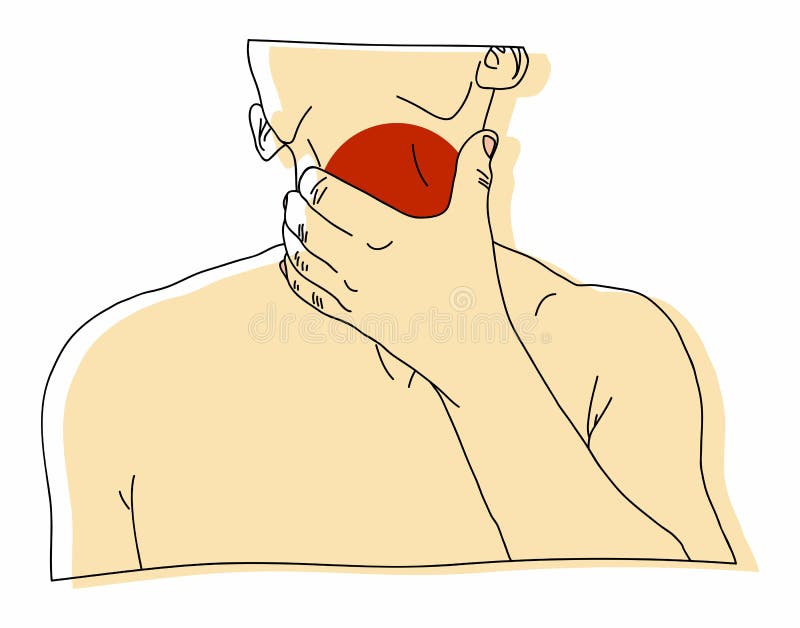 La maschera dissipata dalla malattia della gola illustrazione vettoriale La maschera dissipata dalla malattia della gola illustrazione vettoriale