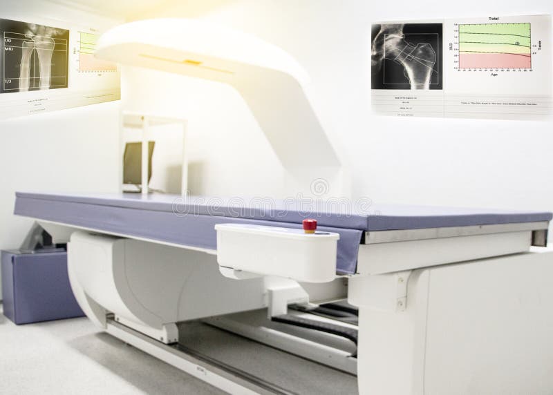 La máquina de la densidad del hueso, está en el departamento de radiografía de hospital usado para diagnosticar síntomas de la os