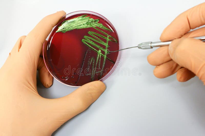La Science de microbiologie - culture de bactéries
