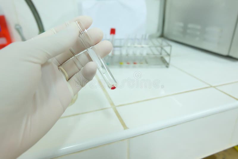 Blood Bank Centrifuge Gel Test in Laboratory Stock Image Image of