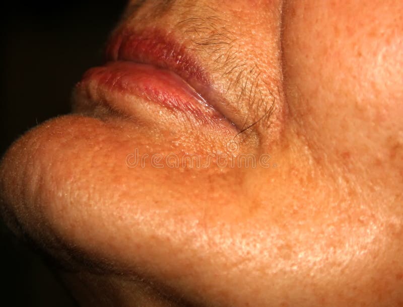 Vello facial menopausia