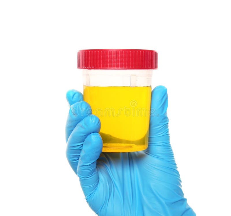 Laboratory assistant holding container with urine sample for analysis on white background, closeup. Laboratory assistant holding container with urine sample for analysis on white background, closeup