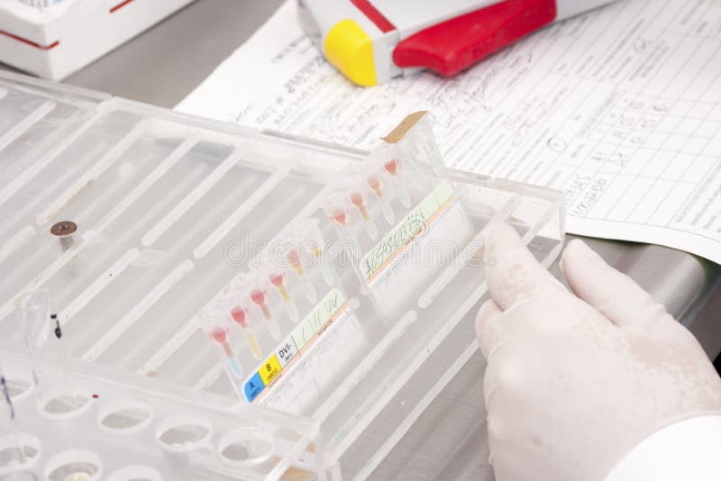 LaboratoryBlood Bank stock photo. Image of carrying 33239930