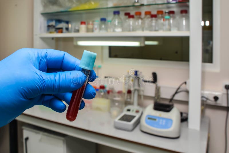 Blood test for COVID19 stock photo. Image of blood 174696444