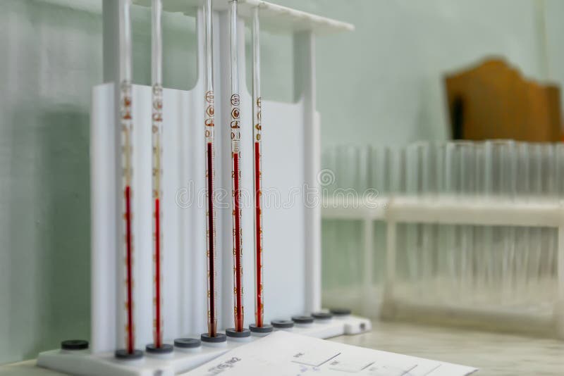 Laboratory equipment for blood analysis. The real work of the laboratory assistant in the hospital stock photography Laboratory equipment for blood analysis. The real work of the laboratory assistant in the hospital stock photography
