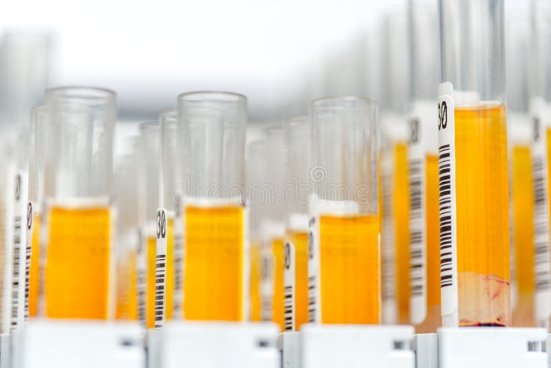 Laboratory glass test tubes filled with orange liquid for an experiment in a science research lab