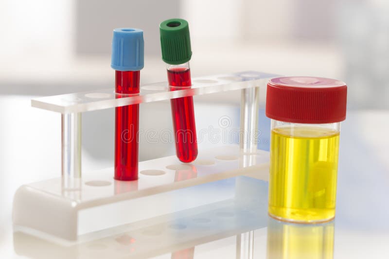 Laboratory Sterile Urine Sample And Blood Test Stock Photo Image