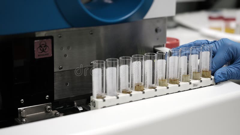 Laboratory technician loading urine samples into automated analyzer. stock footage
