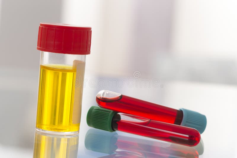 Eliminare Cheaguri De Sange In Urina Laboratório Médico: Amostra E Análise De Sangue De Urina Estéril Imagem