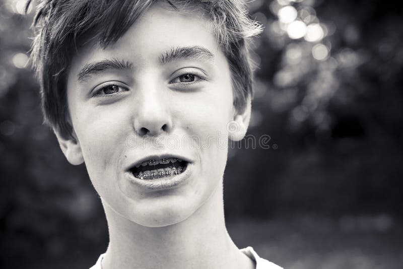 Lachender Teenager mit einer Klammer stockfotos Lachender Teenager mit einer Klammer stockfotos