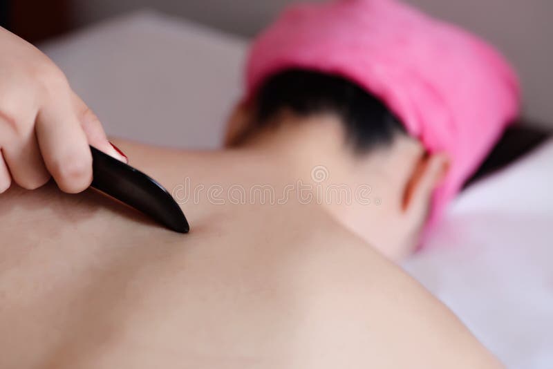 Gua-Sha Acupuncture Treatment on Back