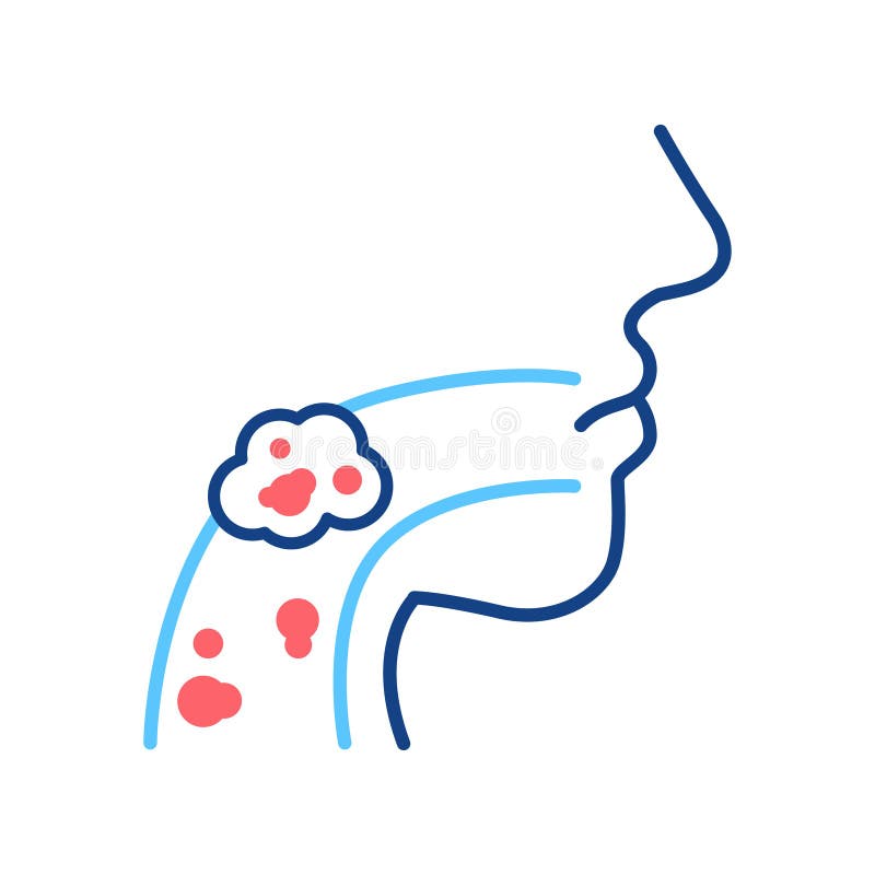 Laryngeal Cancer Icon Stock Illustrations – 128 Laryngeal Cancer Icon Stock Illustrations, Vectors & Clipart - Dreamstime Laryngeal Cancer Icon Stock Illustrations – 128 Laryngeal Cancer Icon Stock Illustrations, Vectors & Clipart - Dreamstime