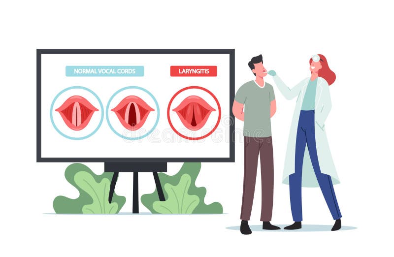 Laryngitis Disease. Tiny Doctor and Patient at Huge Infographics Presenting Normal and Diseased Vocal Cords stock illustration