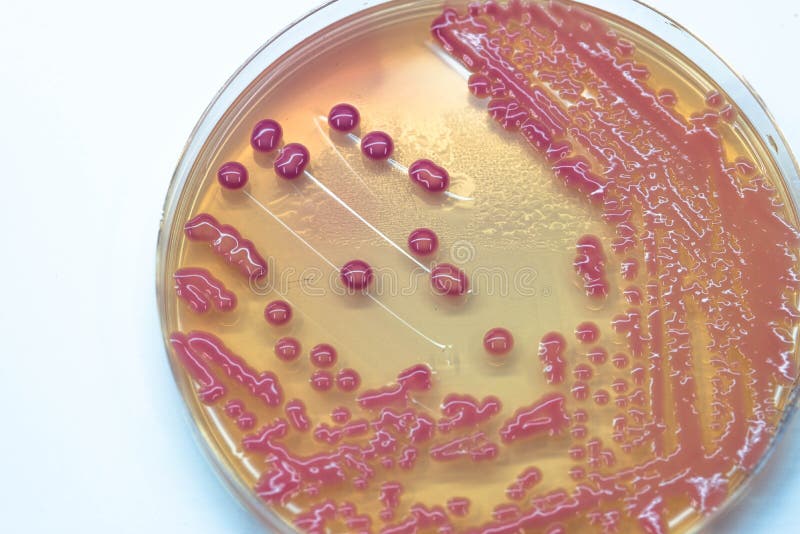Las colonias bacterianas cultivan crecimiento en el agar de MacConkey (el agar del MAC)