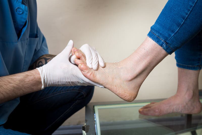 Las manos de un ortopedista del doctor del hombre joven conducen los diagnósticos, prueba del pie de pie de una mujer, para la fa imágenes de archivo libres de regalías Las manos de un ortopedista del doctor del hombre joven conducen los diagnósticos, prueba del pie de pie de una mujer, para la fa imágenes de archivo libres de regalías