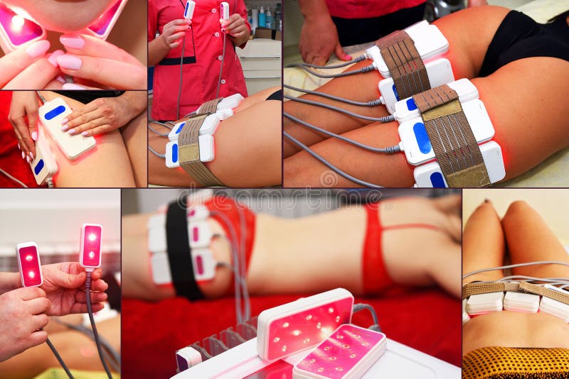 Laser de Lipo Cosmetologia do hardware Cuidado do corpo Esculpir n?o cir?rgico do corpo tratamento de contorno do corpo, terapia imagem de stock Laser de Lipo Cosmetologia do hardware Cuidado do corpo Esculpir n?o cir?rgico do corpo tratamento de contorno do corpo, terapia imagem de stock