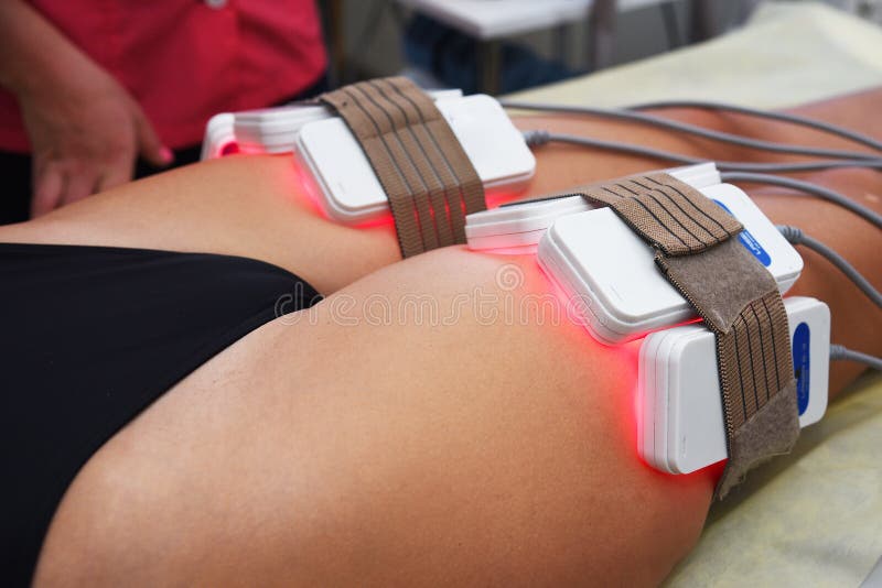 Laser de Lipo Cosmetologia do hardware Cuidado do corpo Esculpir não cirúrgico do corpo tratamento de contorno do corpo, anti-cel imagem de stock royalty free Laser de Lipo Cosmetologia do hardware Cuidado do corpo Esculpir não cirúrgico do corpo tratamento de contorno do corpo, anti-cel imagem de stock royalty free