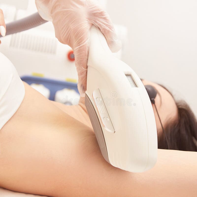 Laser elos medical device. Remove unwanted hair and asteriks. Cosmetology spa procedure at salon. Amprit epilation royalty free stock photography Laser elos medical device. Remove unwanted hair and asteriks. Cosmetology spa procedure at salon. Amprit epilation royalty free stock photography