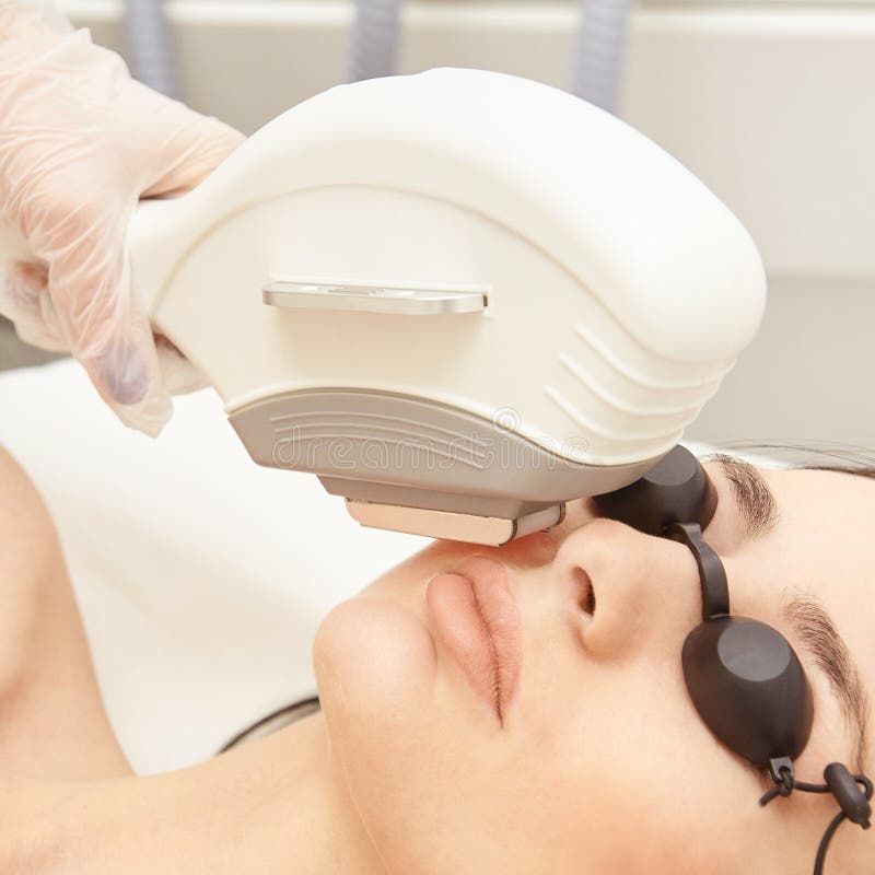 Laser elos medical device. Remove unwanted hair and asteriks. Cosmetology spa procedure at salon. Chin facial depilation