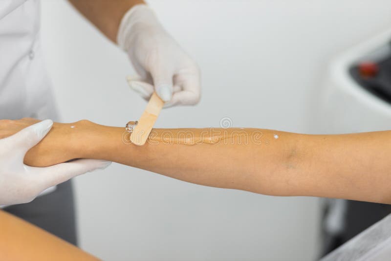 Laser Hair Removal Specialist Applies a Cooling Gel To a Client`s Hand.  Stock Photo - Image of skincare, procedure: 231648628