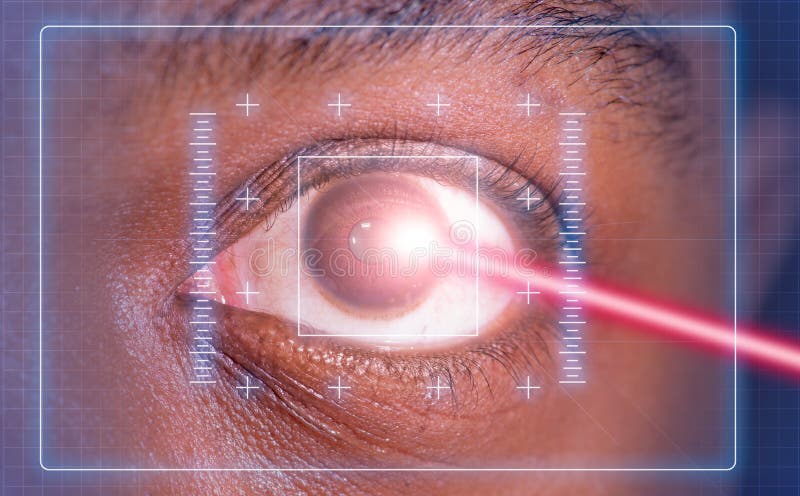 Laser or lasik eye surgery concept  laser beam shining into african america male dark brown eyes also suitable for glaucoma imagery. Laser or lasik eye surgery concept  laser beam shining into african america male dark brown eyes also suitable for glaucoma imagery