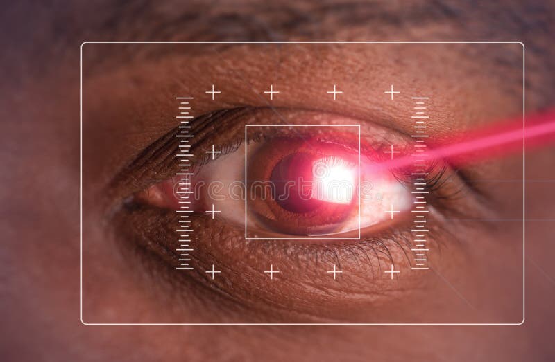 Laser or lasik eye surgery concept, l laser beam shining into african america male dark brown eyes also suitable for glaucoma imagery