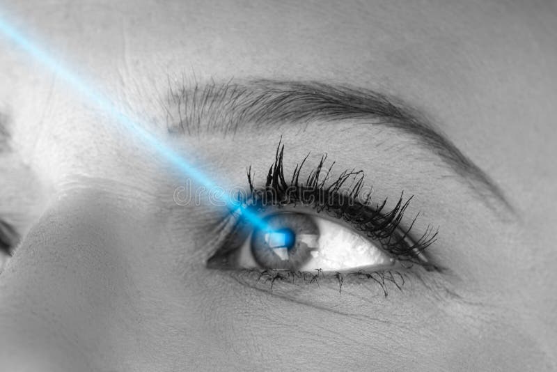 Laser Vision Correction